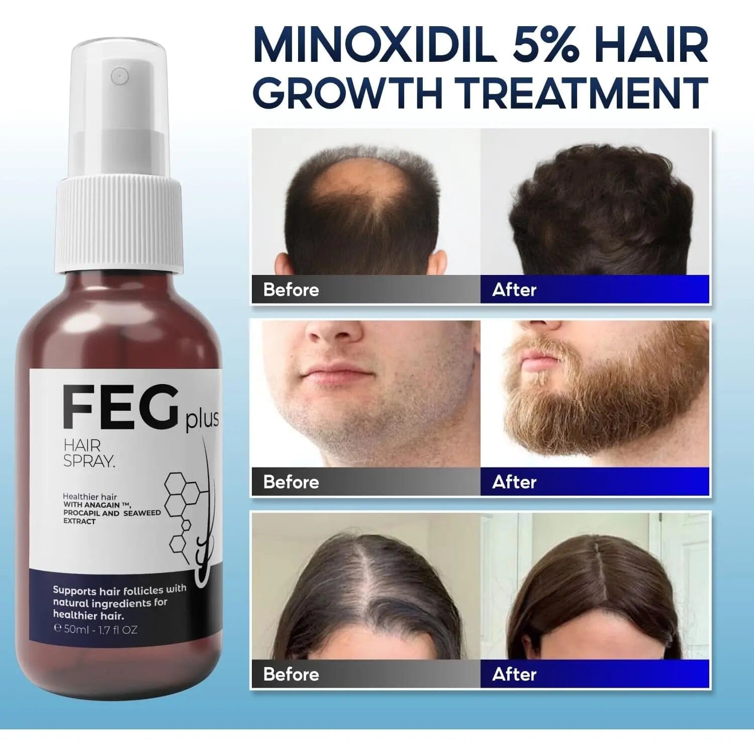FEG Plus Hair Growth Spray رذاذ نمو الشعر من