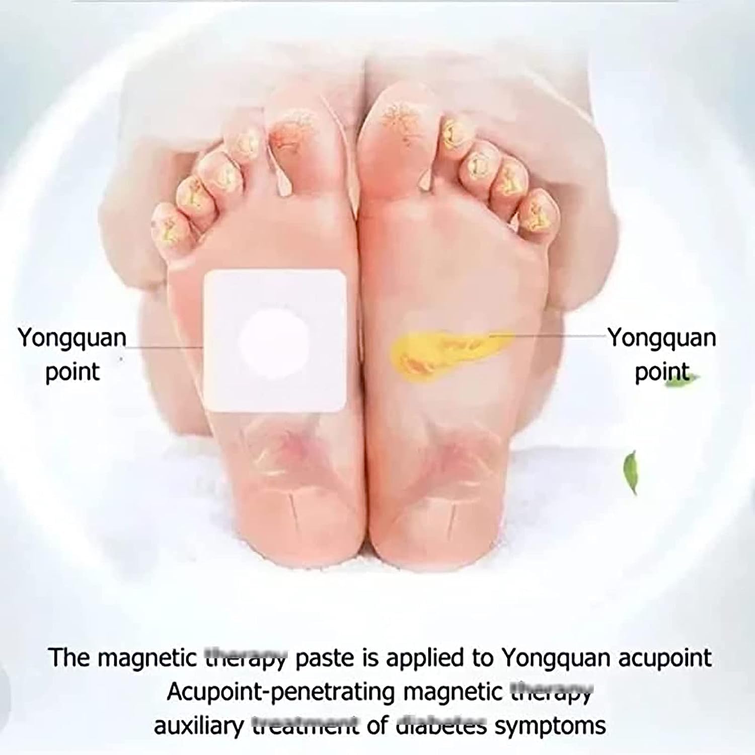 Huatangxiao Acupoint Pressure Stimulation Stickers | ملصقات هواتانغشياو لتحفيز نقاط الضغط والوخز الإبري