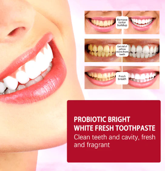 SP 4 Ultra Whitening Toothpaste
